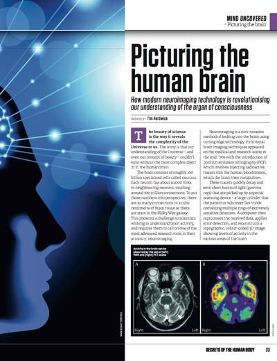 Science Uncovered 06: Article: Brain Mapping - image 2